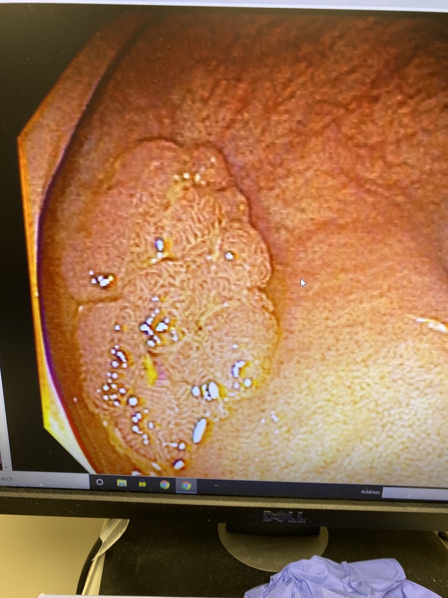 Jonathan Koff tweet media