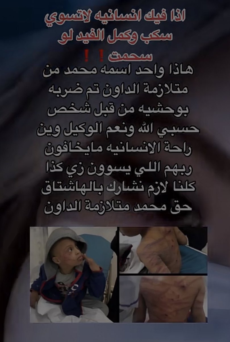 luvyuyul's tweet photo. #حق_محمد_متلازمة_الداون https://t.co/Sdv25sNbNO
