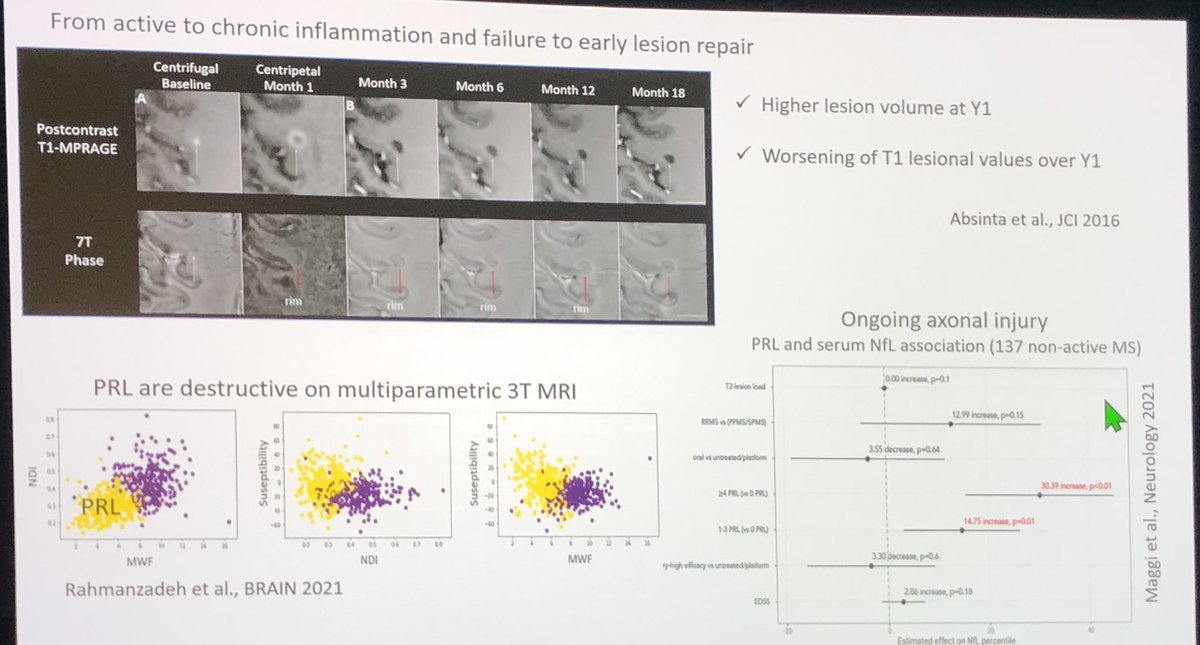 drbarrysinger's tweet photo. Absinta: Paramagnetic Rim Lesions #PRLs on MRI associated with early disability and failure of lesion repair.  Some PRLs can resolve however. #ACTRIMS https://t.co/KcMY43B7tJ