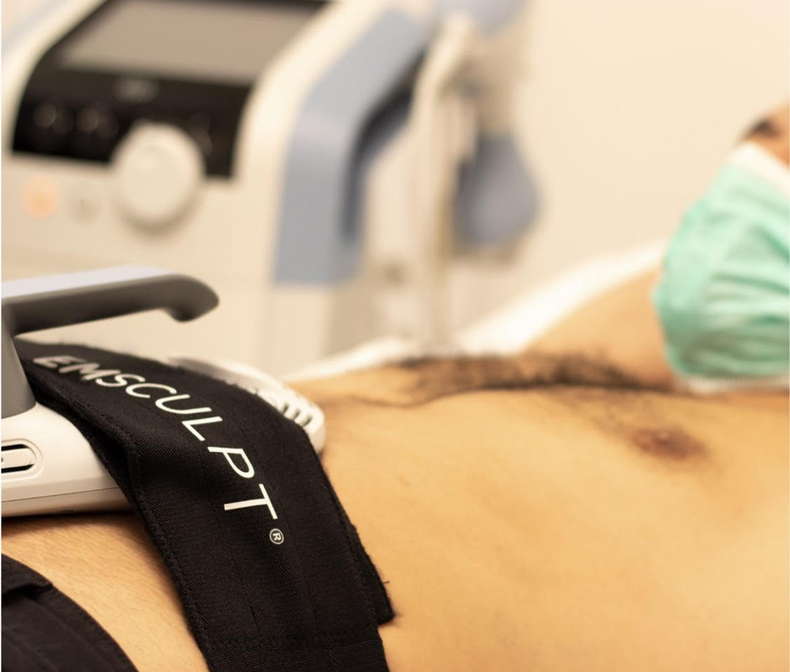 Emsculpt® is a service that is able to incorporate muscle-strengthening with fat-burning to address various body concerns.

Contact us for scheduling and more information:
💌 info@skinfive.com
☎️ Century City: (424) 313-8242
☎️ Pacific Palisades: (424) 322-8780

#skinfivebyavamd