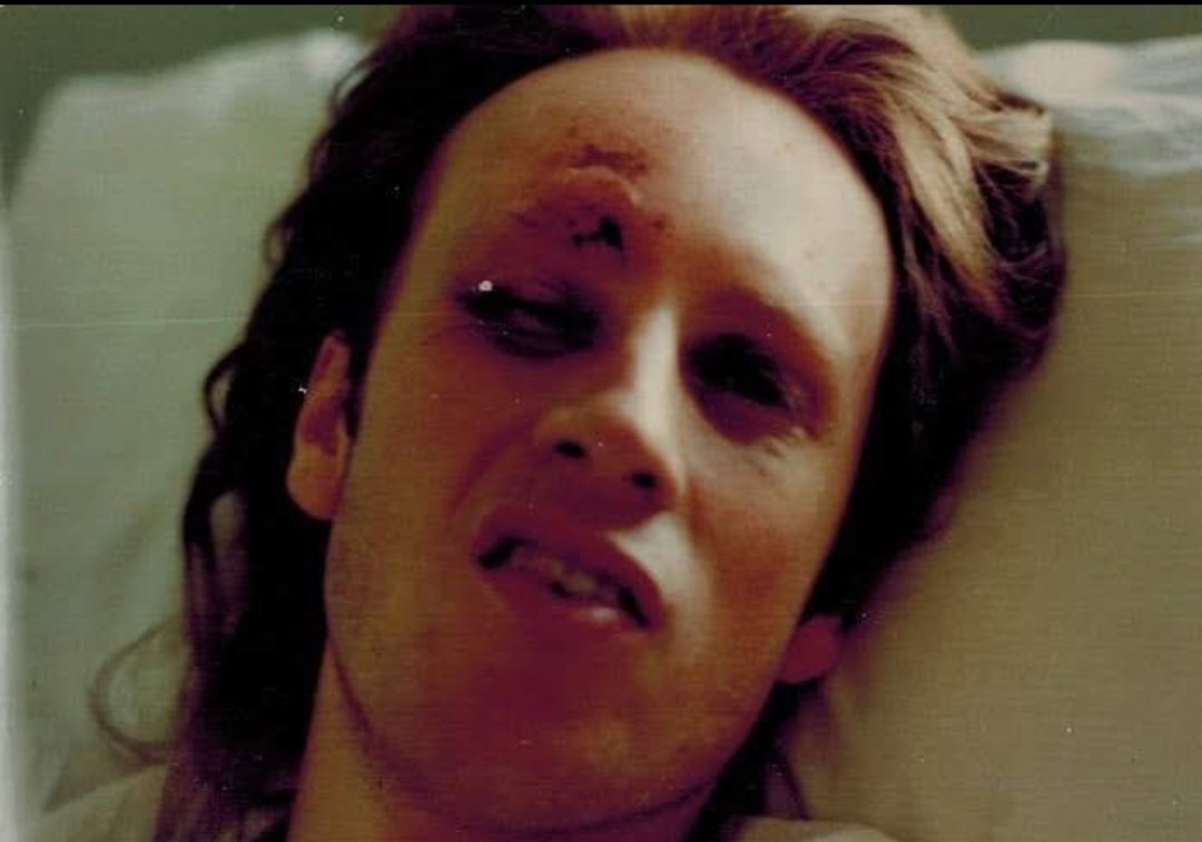 BradleyTim's tweet photo. And one more thing about how moms are always "in the corner" of their kids. I had "long locks" at the time of that accident and one day, when my mother walked into my hospital room, the nurses had scissors out. She yelled "Don't you dare cut his hair!" Yup. Forever #InMyCorner https://t.co/RppMbkEuNg