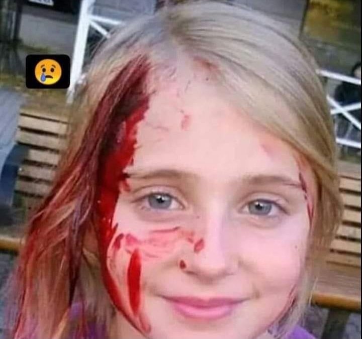 nocontextergun's tweet photo. Ganja, 2020 / Ukraine, 2022!
History repeats itself! Both photos are evidence of vandalism of minors by Russian weapons. To remain silent against oppression is to be a partner in oppression. 
#StopRussia #StopWar #Ukraine #StandWithUkriane #SlavaUkraini https://t.co/1IIjKerdsl