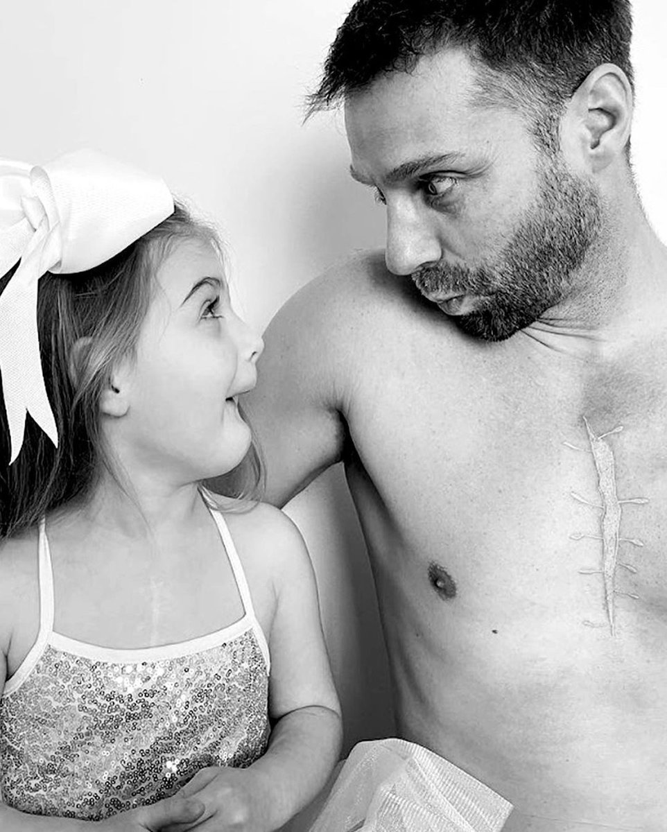 Four-year-old Everly has a visible surgery scar on her chest after multiple heart operations before she was one. Last month, her dad got a tattoo on his chest that looks like her scar. (📸: Lauren Backe)