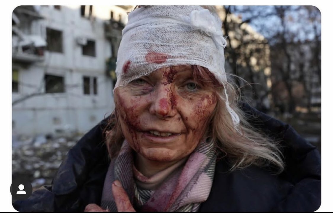 #NoToWar 
Praying for innocent &amp; powerless people of #ukraine &amp; #russia 

Its 2022 and we still have innocent citizens suffering around the world 💔 #UkraineRussiaWar #UkraineRussia #UkraineRussiaConflict