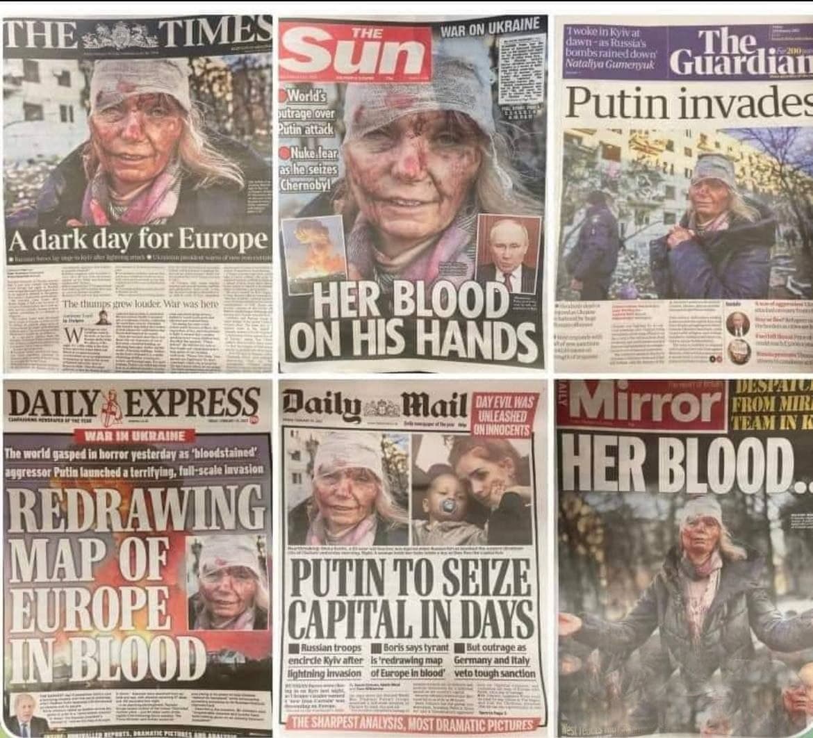 La prensa occidental usa la foto de una mujer que sobrevivió a una explosión de gas en el 2018 y la colocan como víctima de Putin en el 2022.
<a href="/marianagc/">Mariana Gómez del Campo</a> hace lo único que sabe hacer, mentir igual con la misma imagen.

La primer víctima en una guerra, es la verdad.