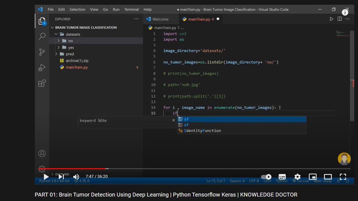 Day-26 | 26-02-22 

- Progress of the day: Started doing a brain tumor detection project by watching a tutorial.
- Feeling: Excited
- Time: 1 hour

#100DaysOfCode #100daysofcodechallenge