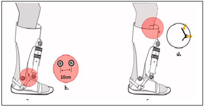 MapsciP's tweet photo. Current Concepts Review: Orthotics In Post-operative Foot And Ankle Surgery

https://t.co/0O82OxgPLM https://t.co/fsEcCerCpP