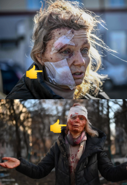 Essa mulher está em várias capas de revistas e jornais pelo mundo, mas tem algo beeeem estranho.
O ferimento na bochecha aconteceu antes ou depois da bomba?
Pq alguém troca de curativo no meio do entrevero?
🤔