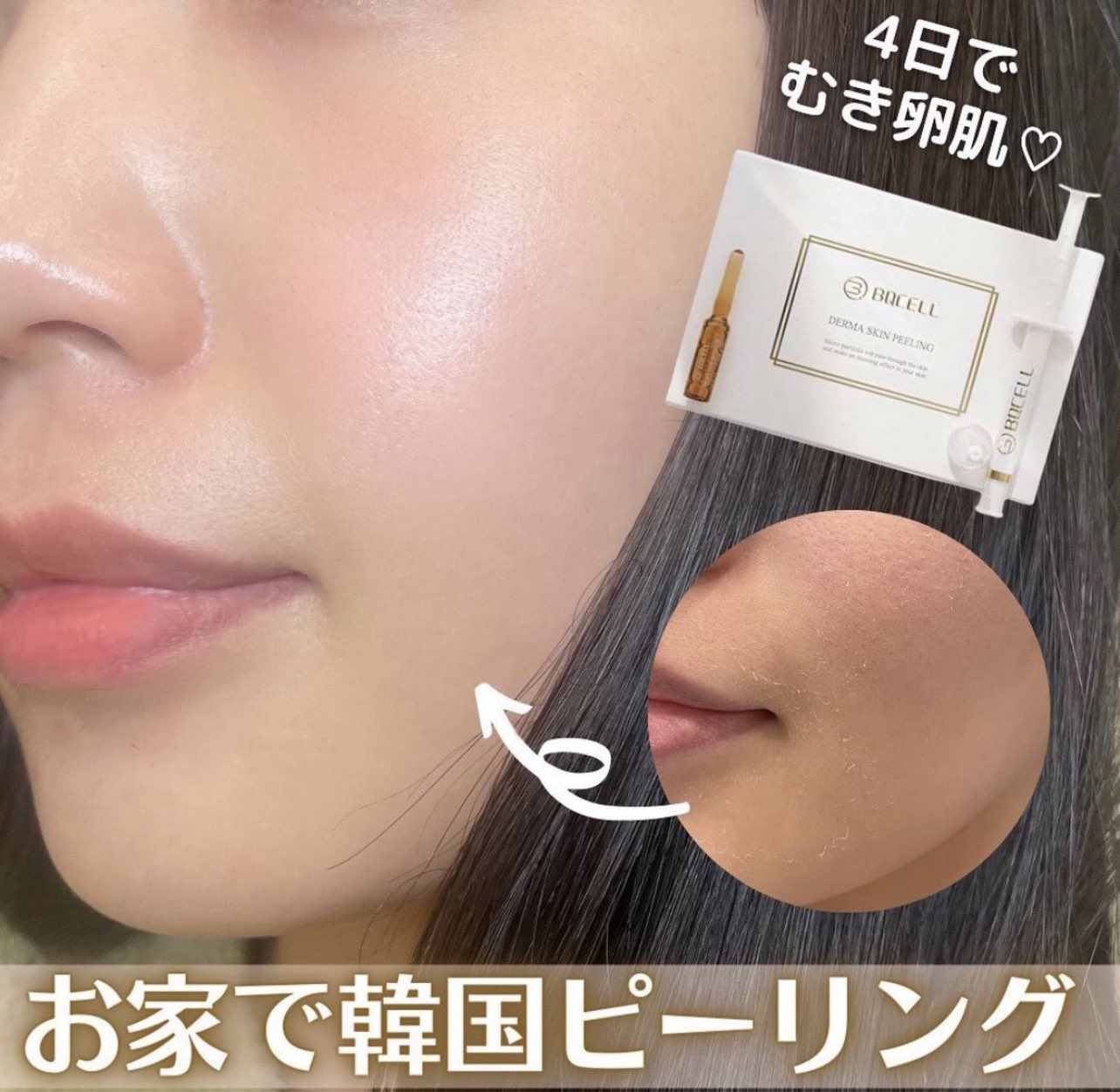 新品未開封/ダーマスキンピーリング/BQCELL/ハーブピーリング/韓国