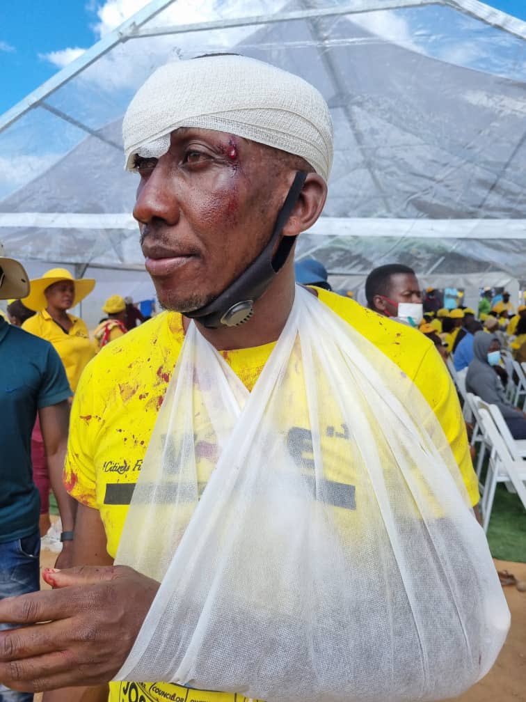 PastorEvanLive's tweet image. Today I’m saddened by this disgusting barbarism of Zanu-PF. They have failed us utterly &amp;amp; convincingly. It is time my countrymen to put aside our differences &amp;amp; think clearly about the legacy we are leaving. Zanu-PF MUST GO! #FambaNeroFamba #YellowNation