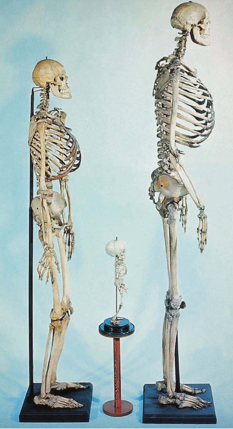 world-biggest-human-skeleton
