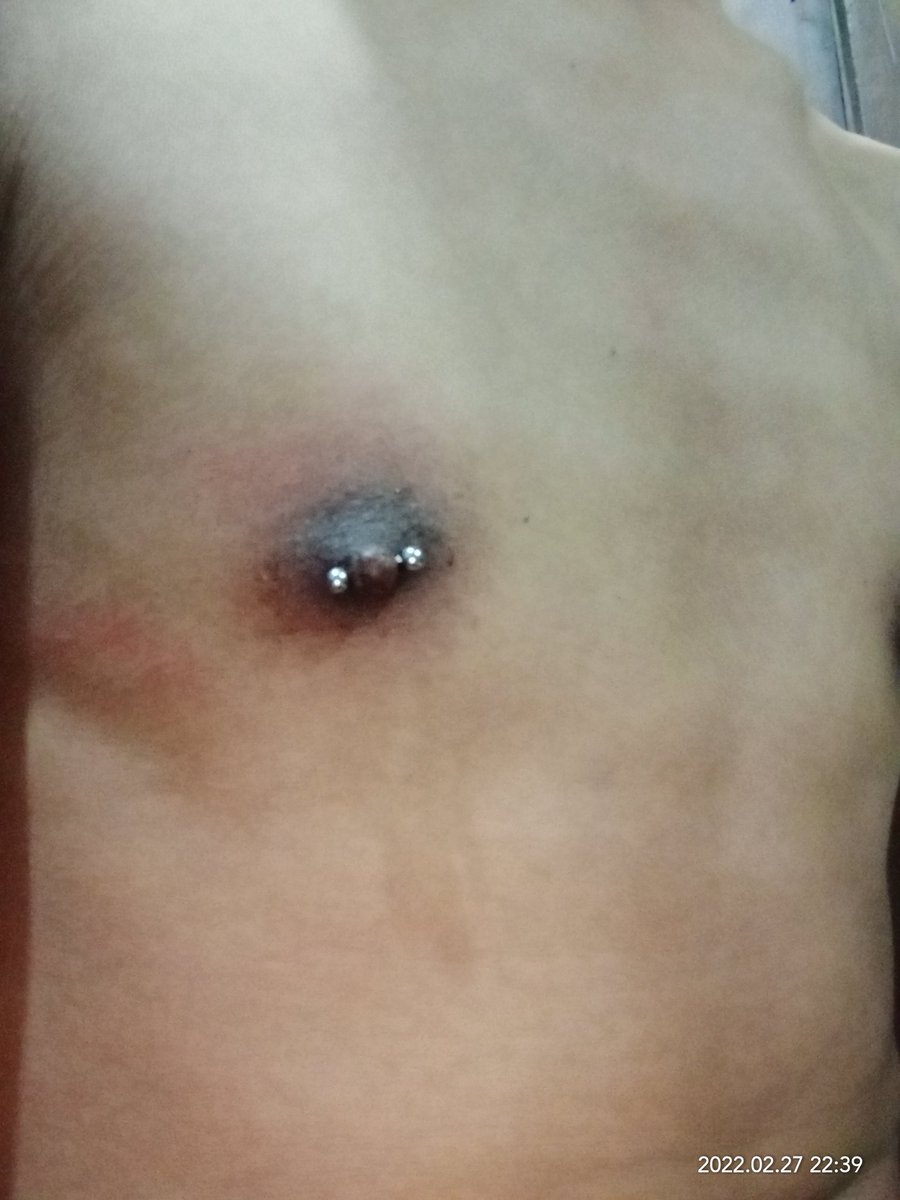 _nippleeee tweet media