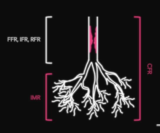 Giorgio A. Medranda MD, FACC, FAHA, FSCAI tweet media