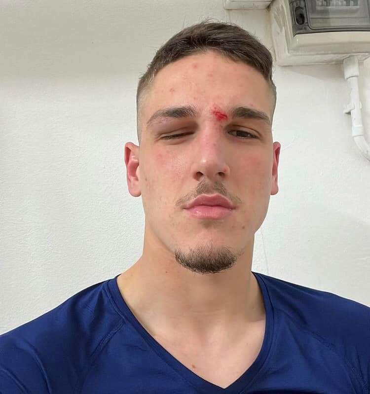 aarnicaa's tweet photo. quando pur di aver tre punti in classifica, ti becchi tre punti in faccia 🥲 ti amo zaniolo 💛❤️
#SpeziaRoma https://t.co/Vlk87C3wOi