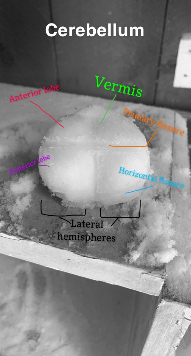 UticaBiology's tweet photo. More #neuroscience #snowsculptures from our snow day Friday! These frosty #neuroanatomy works of art include a #pyramidal cell by Emma Broedel and a life-size #cerebellum by @lyss_vb_sb Alyssa Raniewicz! https://t.co/1SGeo6NpkN