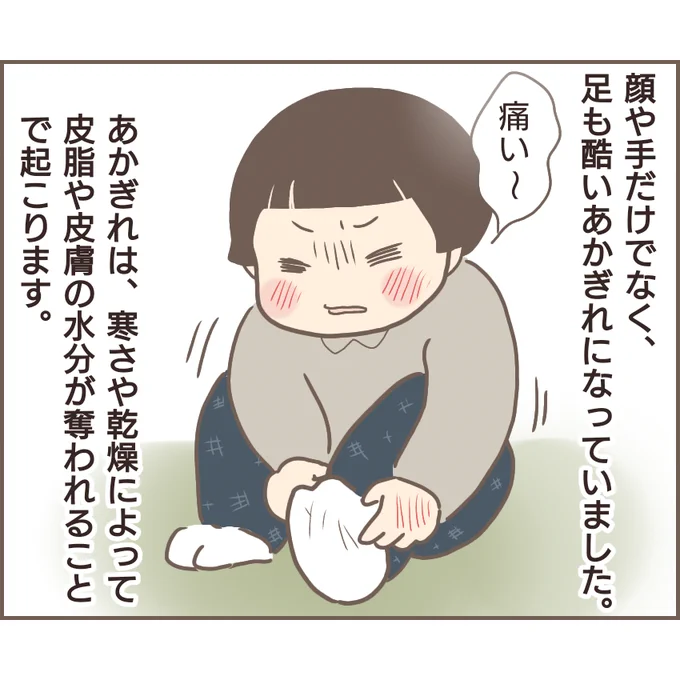 親に捨てられた私が日本一幸せなおばあちゃんになった話【23】私が幼い頃、家にもまだ掘りごたつがありました。床下に灰や炭を入れて、その上に金網を乗せて使用するのですが、うっかり裸足で足を入れると高熱の金網で火傷しちゃうんです (1/2) 