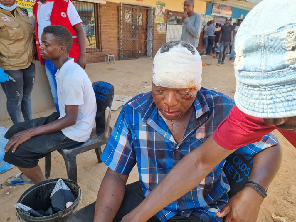 Zimbabwe is a War Zone 

The government is fighting citizens