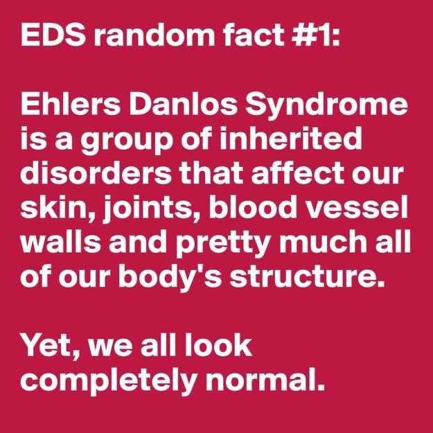 February 28 is #RareDiseaseDay 
I have a genetic disorder called Ehlers Danlos Syndrome. I consider myself lucky because I’m able to function fairly normally with EDS/POTS which has been so very debilitating to many others.
#ShowYourStripes #zebra #EDS 

ehlers-danlos.com/what-is-eds/