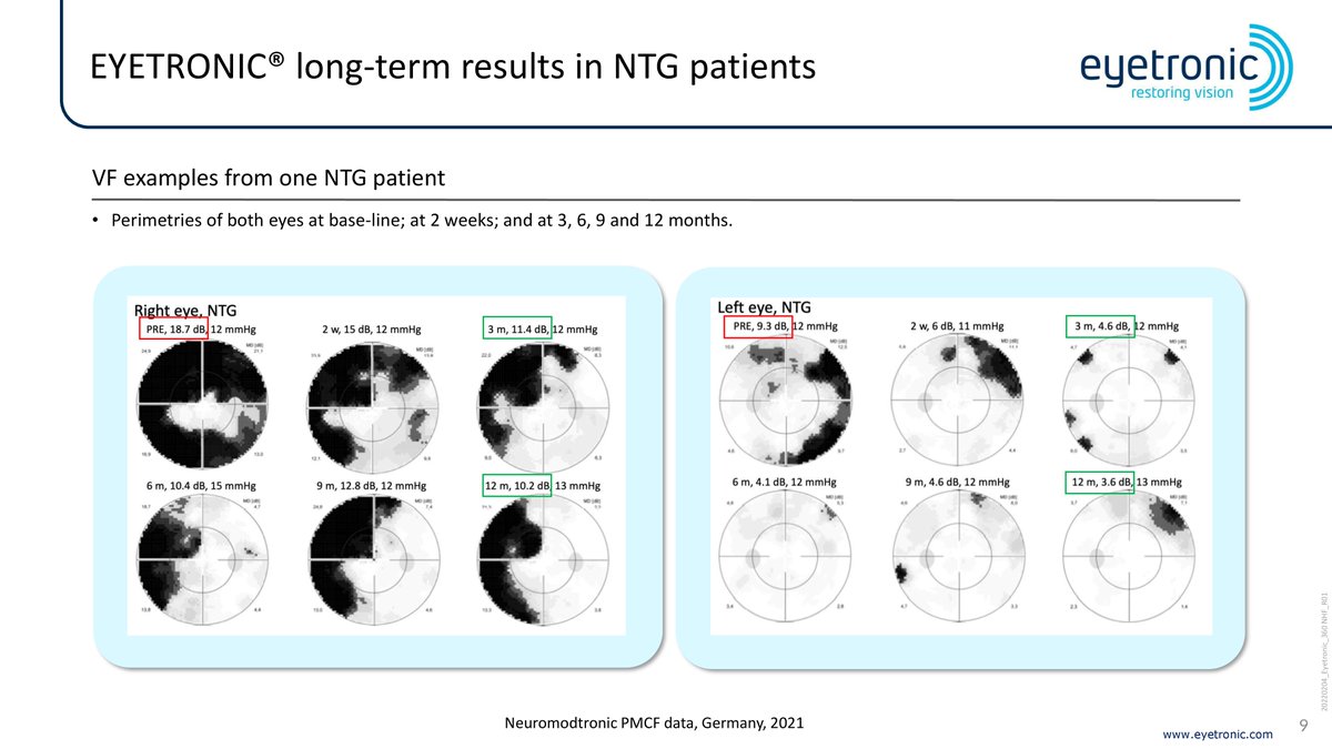 Eyetronic_'s tweet photo. In February 2022 we could present the Eyetronic Therapy at the 11th annual Glaucoma 360 New Horizons Forum in San Francisco, USA.

Attached you can find a presentation about the Eyetronic Therapy shown at the event in english.
#Eyetronic #Glaucoma

pt. 3 https://t.co/6tLsvu9BKT