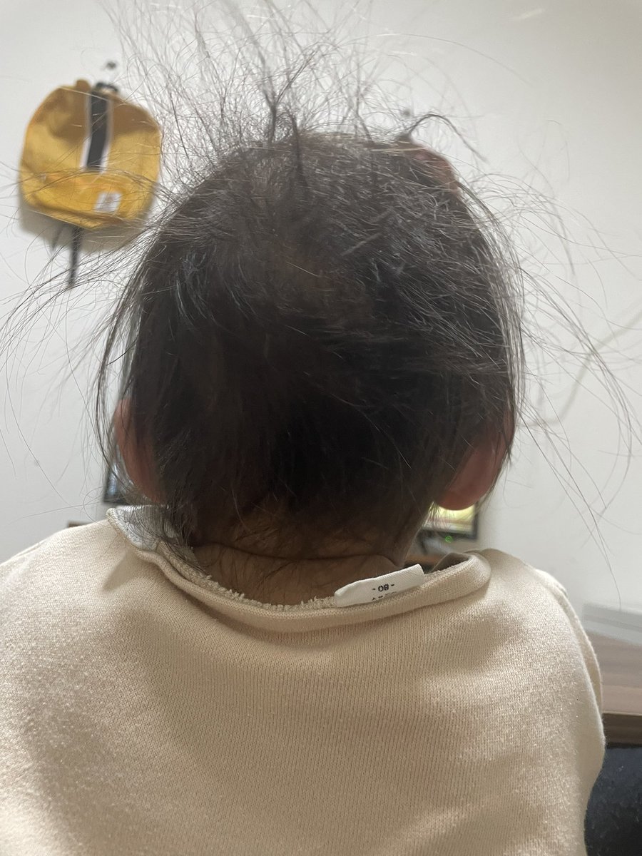 minachomaru's tweet photo. 寝癖がやばすぎる笑 https://t.co/ZXR7yks06j
