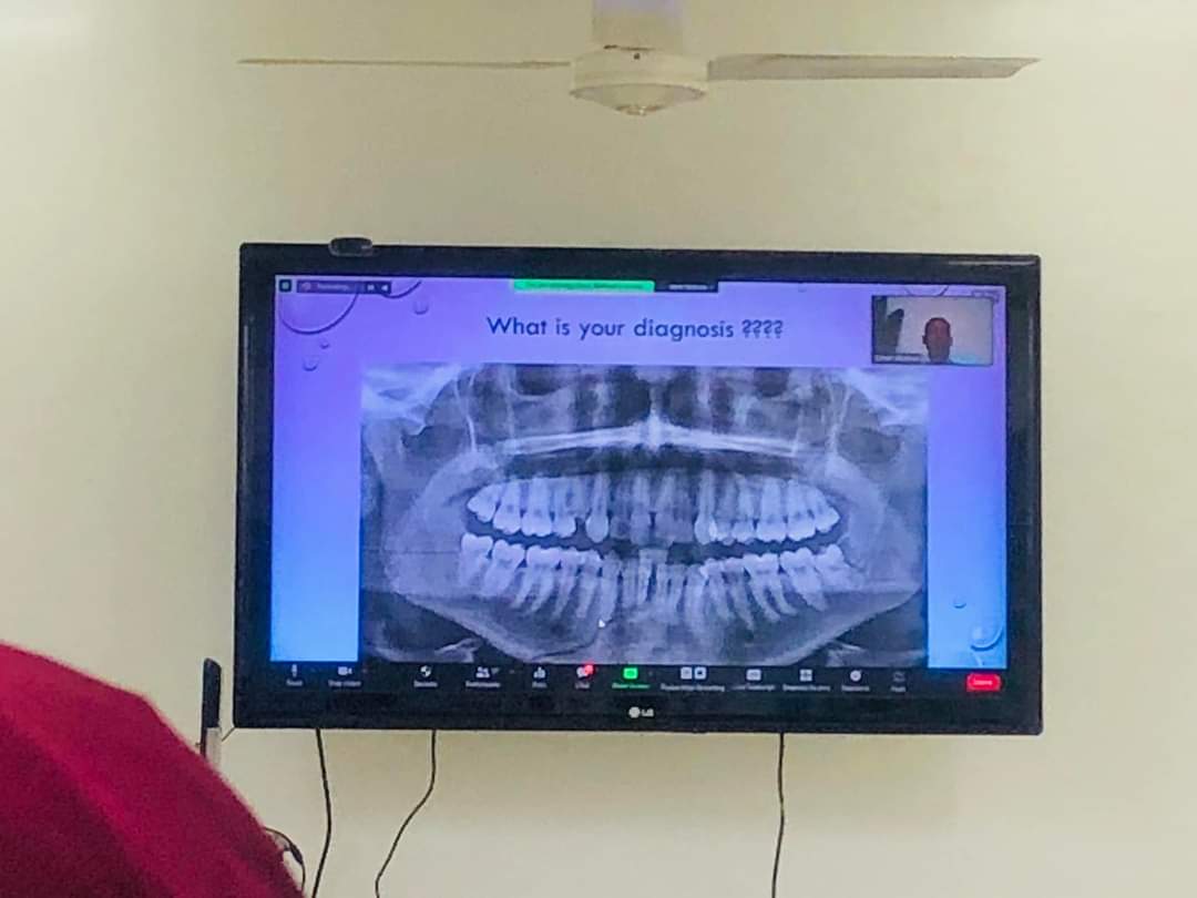 IMDC_sd's tweet photo. ⭕️Part of Saturday's attendees for OMFS Course session that was held today Feb 26th,2022 at ProjechtECHO IMDC hub.
⚫️Topic: Atypical maxillofacial trauma.
⚫️Subject matter expert: Mr. Omer Abdoun.
⚫️Case presenter: Dr. Mohammed Siralkhatim https://t.co/0Flc8KjMa1