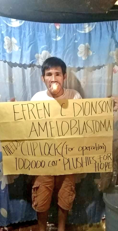 PlushiesForHope's tweet photo. Please don't scroll without sharing 

We are raising funds for Tatay Efren's operation. The cliplock costs 100,000 and they still need 75,000 to continue with the surgery. Tatay Efren is diagnosed with Ameloblastoma and his family cannot sustain all the operation cost + https://t.co/KCH3eJdyna