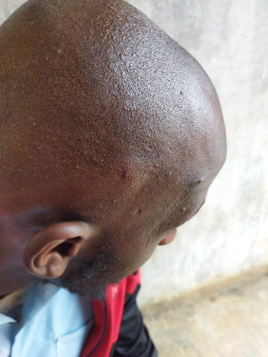 PeterNj05786499's tweet photo. A parent in Thika has threatened to sue a head teacher of a day secondary school in the area who disciplined her form 4 student for not shaving the hair & beards. The mother said that she has already made a formal complaint at nearby police post against the incident.
#WhoisRight? https://t.co/2IwktfDdwg