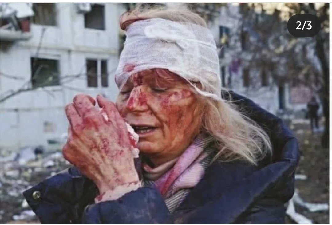 AboRawan8886's tweet photo. They did it in Syria, and now they are doing again in Ukraine. Dramatic pictures, Ukrainian woman who was seriously injured, and topped the international and Western newspapers, and she took up arms to fight the Russian army.
#UkraineRussiaWar
#الحرب_الاوكرانية_الروسية 
#Ukraine https://t.co/Nm3znKQmhG