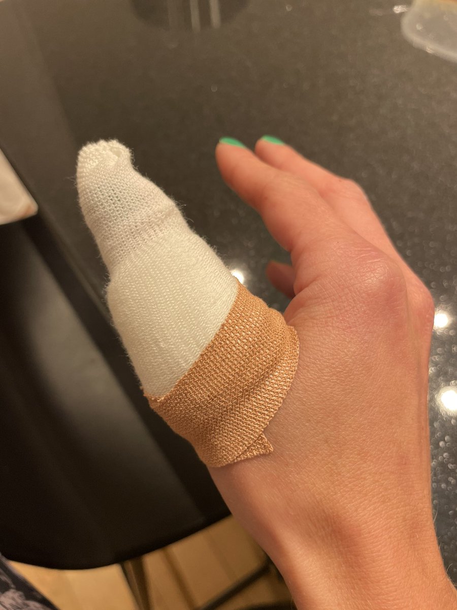 Tash_Burton's tweet photo. Must learn to be less clumsy 😬🔪🤦🏽‍♀️ - thank you @WythenshaweHosp for stitching me back together! https://t.co/F2JYdN18hx