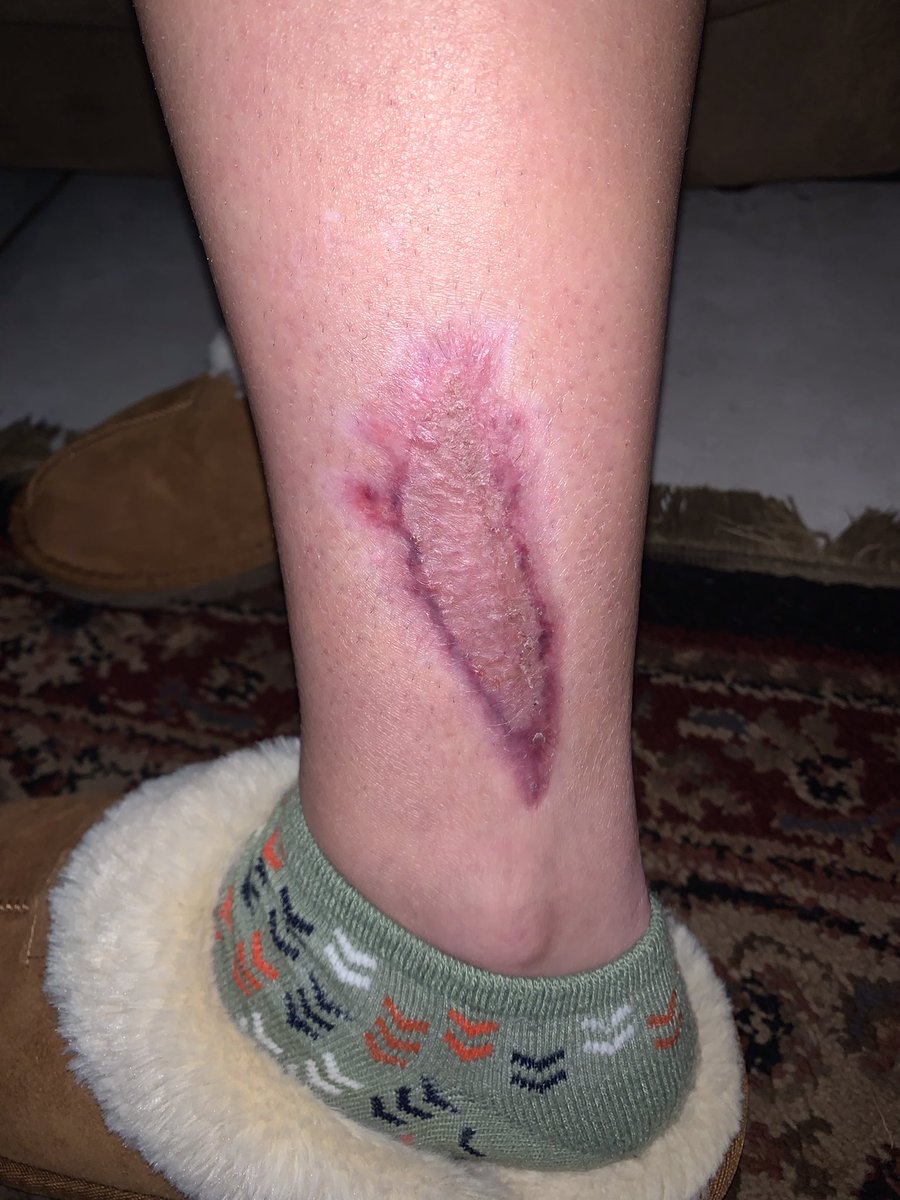 Kevin McCaig tweet media