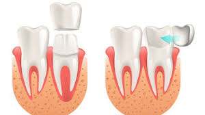 nV_Violet's tweet photo. https://t.co/CFschODde0

https://t.co/ZS43pkaHDQ

https://t.co/XOwSAyF71G

Auburn Dentist https://t.co/ye5fDMNeEV