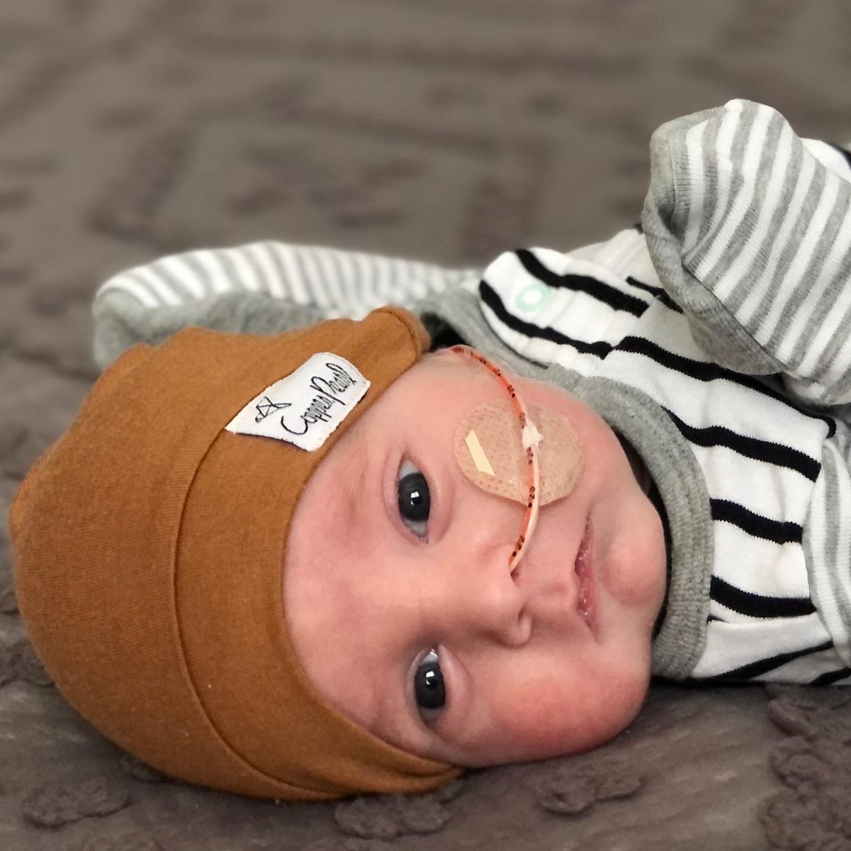 StoryofHarryJ's tweet photo. Since 2008, #RareDiseaseDay has created a global rare disease community unified for one goal: uplifting and empowering those affected by rare diseases. We are excited to join @NORD to bring light to rare diseases. #ShowYourStripes https://t.co/TEBB3i4fRS
