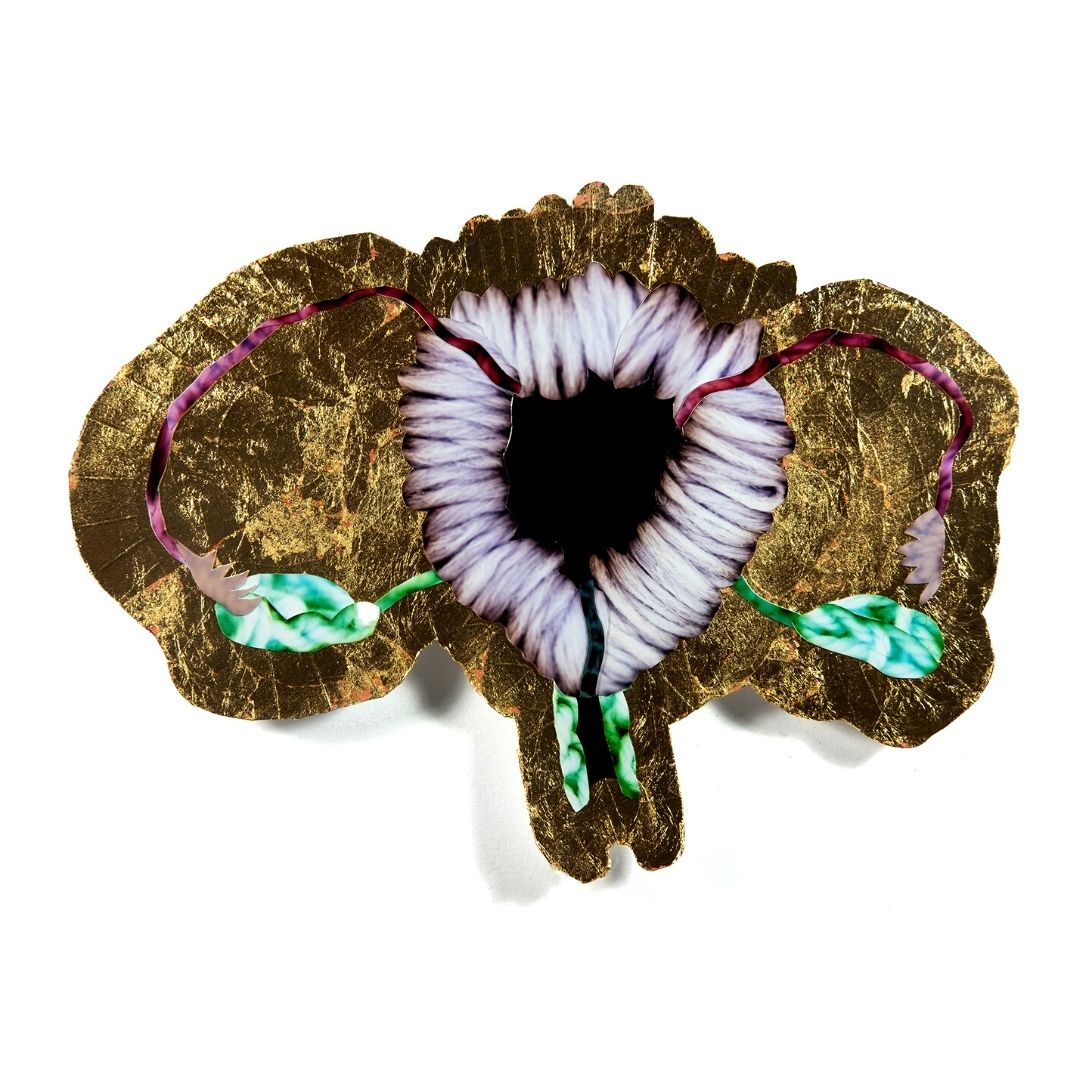 HysteriaProjec1's tweet photo. This is Toni, with #PCOS (but no #cysts). PCOS is a #hormonaldisorder that affects approximately 1 out of every 10 people who is menstruating. It doesn't always manifest the cysts for which it is named. Project funded by @BundesKultur https://t.co/GZt4AAJwTg