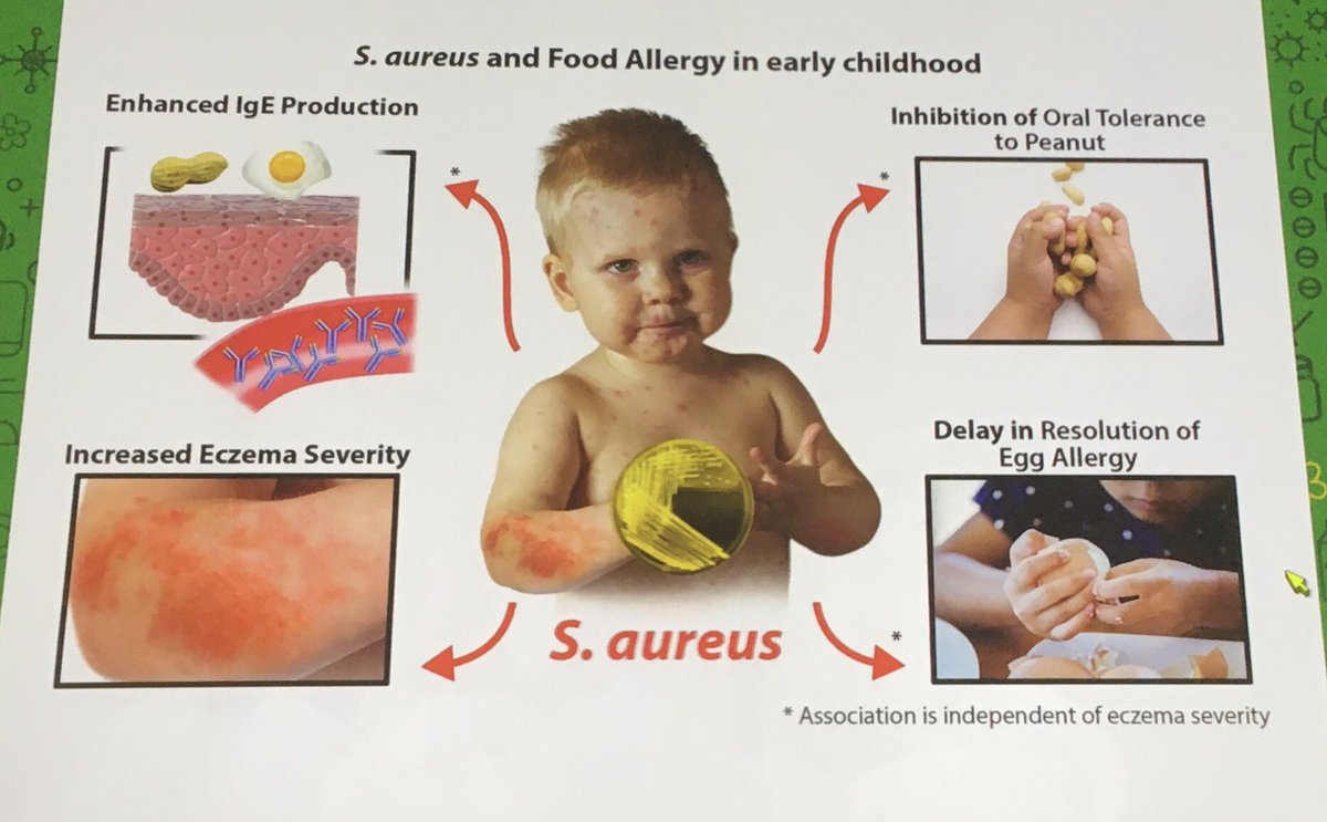 S. aureus negatively influences food allergy in early childhood. @GoAllergy #AAAAI2022