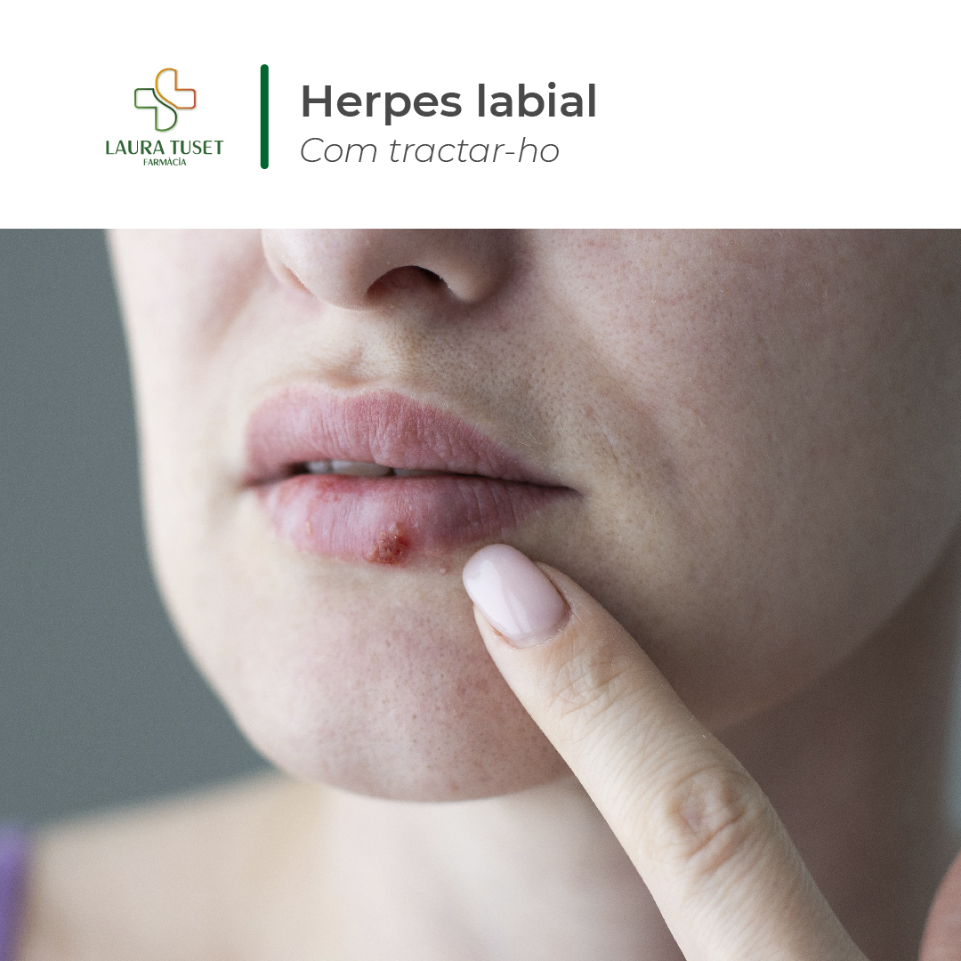 farmaciatuset's tweet photo. 😷L'herpes és causat per un virus que poden afectar usualment als llavis, és contagiós i per això hem d'anar amb compte.
👉🏻Normalment, desapareixen al cap d'una setmana, però pot ser molest.
✅Vine a la farmàcia i t'ajudarem a tractar-ho de la millor manera.

#farmacia #vilaseca https://t.co/Ut9gVdRoW9