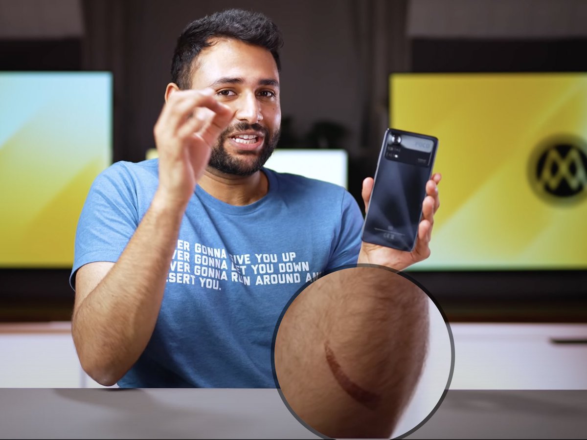 techyped's tweet photo. omg that looks like a burn mark🥶 arun you good ? @Mrwhosetheboss https://t.co/vWyKH1acda