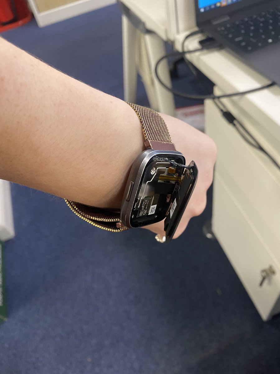 JessEbony's tweet photo. @FitbitUK can someone help me please, the face just popped off out of nowhere 😭😭 https://t.co/6hCT3UgXz7