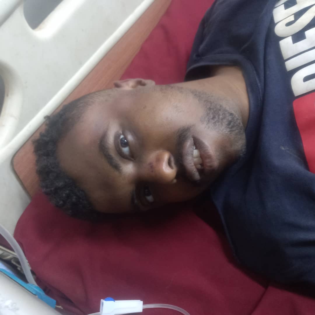 Girifna's tweet photo. الترس دا مصاب في اي حتة في جسمة وفاقد الوعي الان في مستشفى الاربعين .. مجهول الهوية .. علي من يتعرف علية التواصل مع مستشفي الاربعين .
#مليونية28فبراير https://t.co/qHwH2yYZie