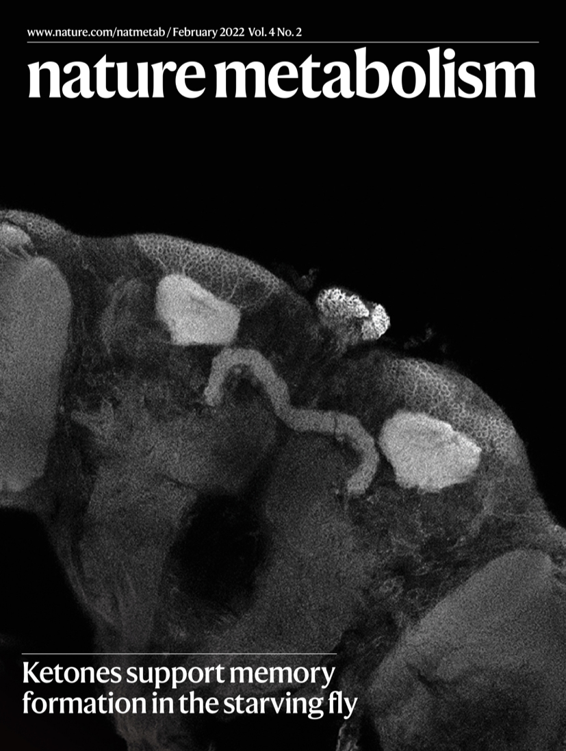 NatMetabolism's tweet image. ✨ FEBRUARY ISSUE ✨ Fuel your day with the latest research on #ketones &amp;amp; memory (our cover) 🪰, beta cell #senescence, human pancreatic islet #omics, skeletal muscle metab &amp;amp; adipose tissue #inflammation. Take a look:

nature.com/natmetab/volum…