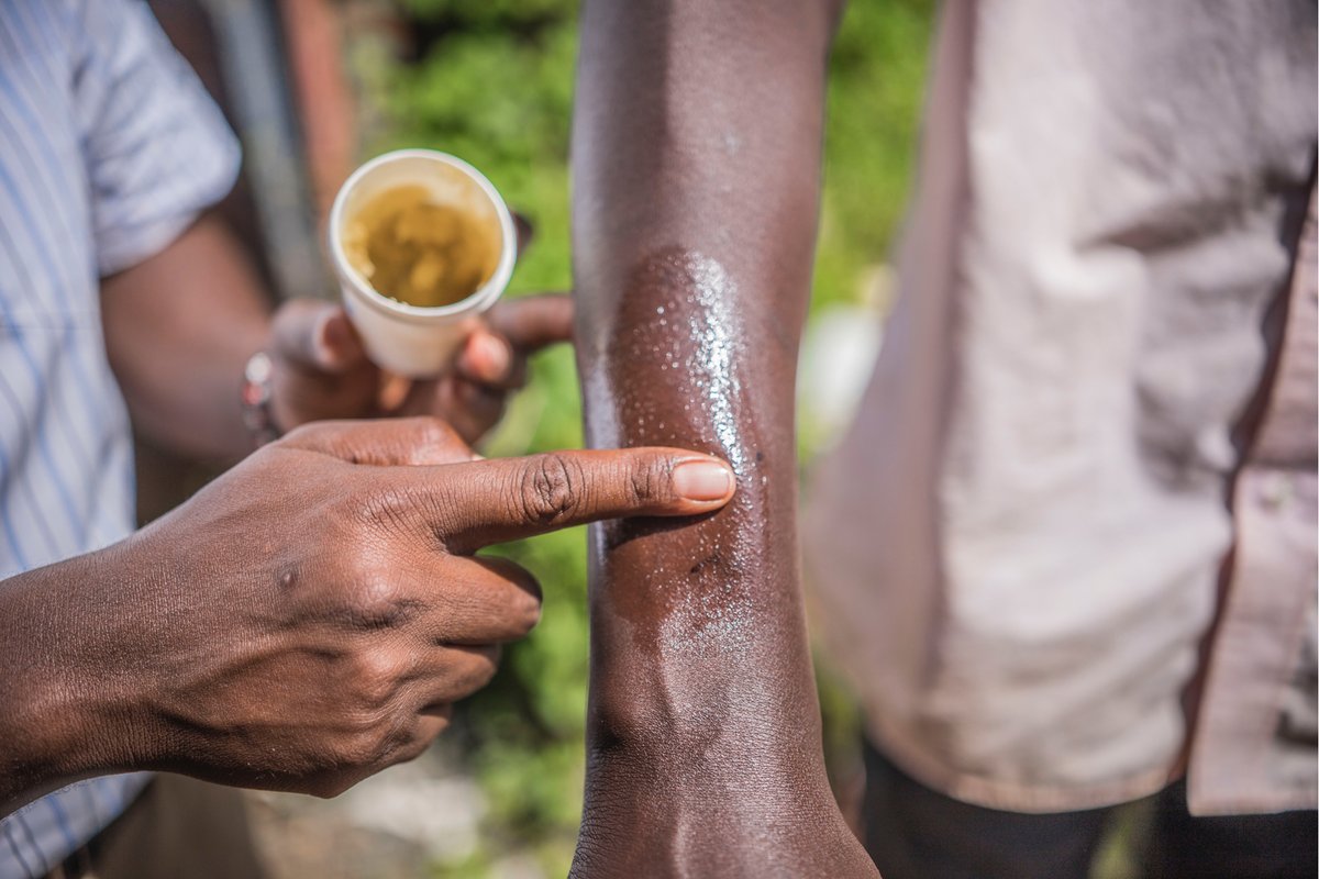 Thrive4Good's tweet photo. Topical herbal treatments can be a gentle yet effective way to address painful scrapes, itchy rashes, and dry, dull skin.

These topical remedies not only nourish your skin, but can also create a gentle seal that protects and helps your skin absorb nutrients.

#artemisiaoil https://t.co/mv9r9m5Cam