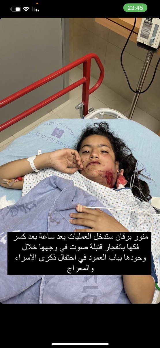 uzisall's tweet photo. Munawar Burqan is with special needs girl, was hit with a stun grenade by the occupation forces in Bab Al-Amud in occupied Jerusalem. 
She's now with a broken jaw and deep wounds in her face. 

#IsraelCrimes https://t.co/FZFMfpOvyU