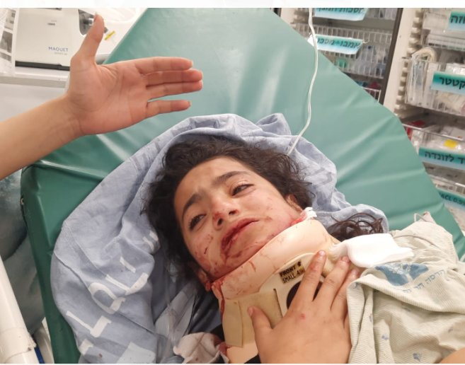 MundoAlerta2022's tweet photo. 🔴 #Israel |  Lamentamos que esta imagen pueda herir susceptibilidades, pero es algo que esta pasando en estos momentos (Israel contra Palestina). 

Nawar Burqan, de 11 años, niña que resultó herida por una granada, Hay 20 detenidos la mayoría niños, y 30 heridos. https://t.co/XAw0NbwR0g