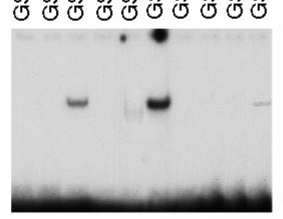 MicrobiomDigest's tweet photo. Wow. 
Published in @Nature, 1998, cited over 600 times. 
Correction for some other issue, but can you spot something else in this figure?
#ImageForensics https://t.co/3EnJh9bgfq