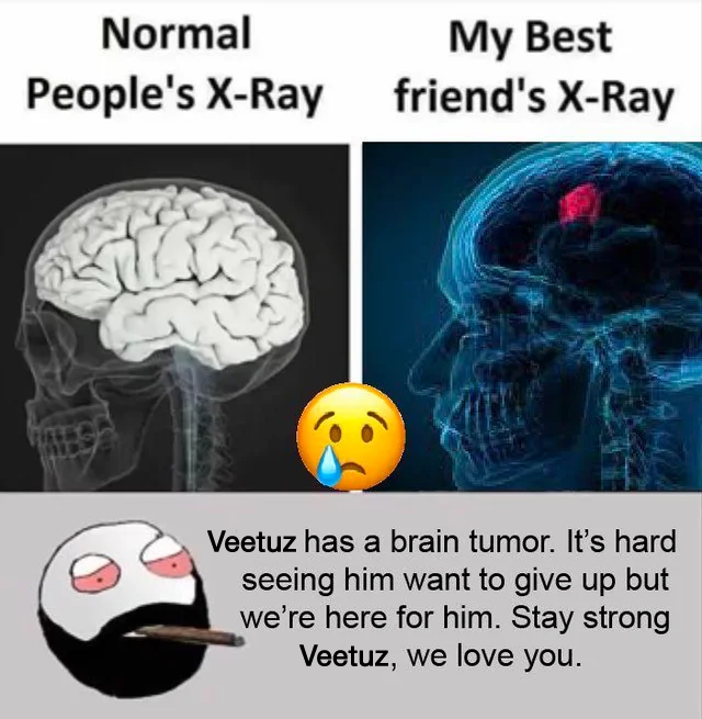 surfstab's tweet photo. @veetuzu https://t.co/XWYRSlRcjB