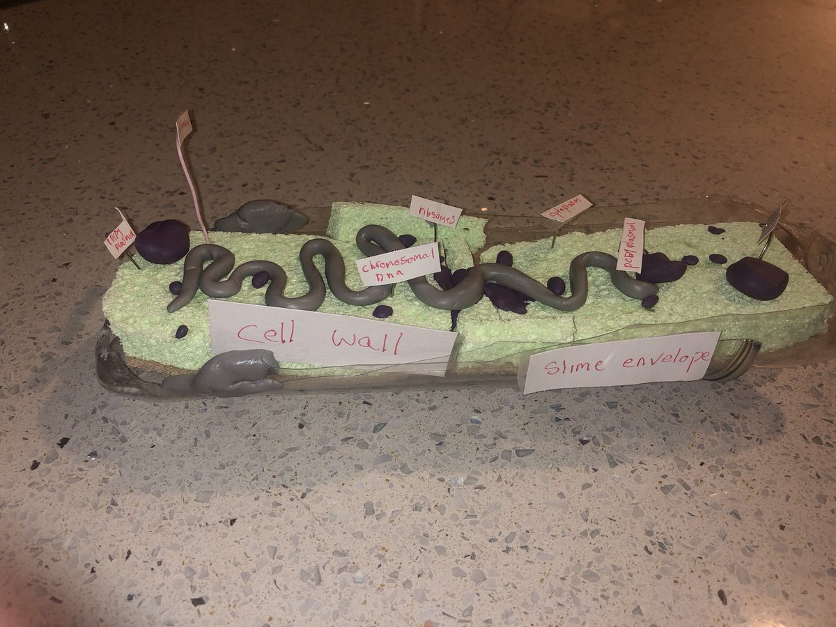 SpiralSayD's tweet photo. Bubonic plague model for school. https://t.co/1mMkyRrEou