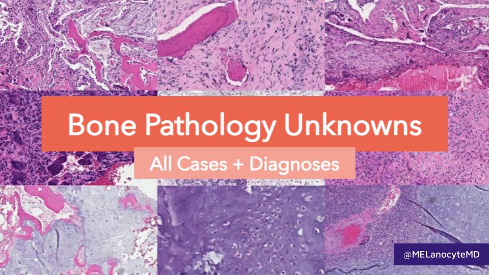 MELanocyteMD's tweet photo. Enjoy the #bstpath unknowns I've been posting recently? 

Now you can view them all in one place!

Links to all cases + answers:
https://t.co/RzsRHkEqpt https://t.co/kXdIuDkE1e