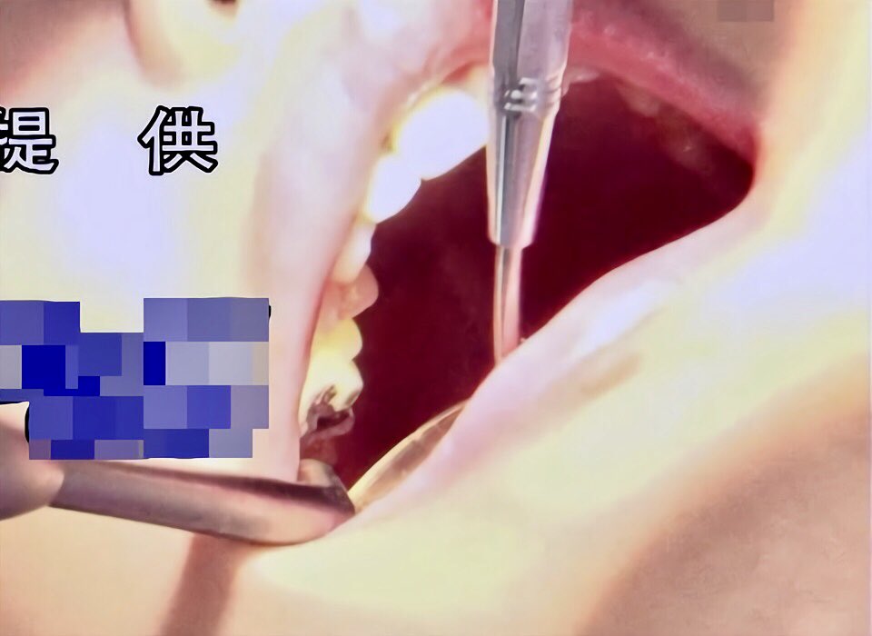3DThirty's tweet photo. 虫歯な佐野ひなこ https://t.co/WN05kfW98h