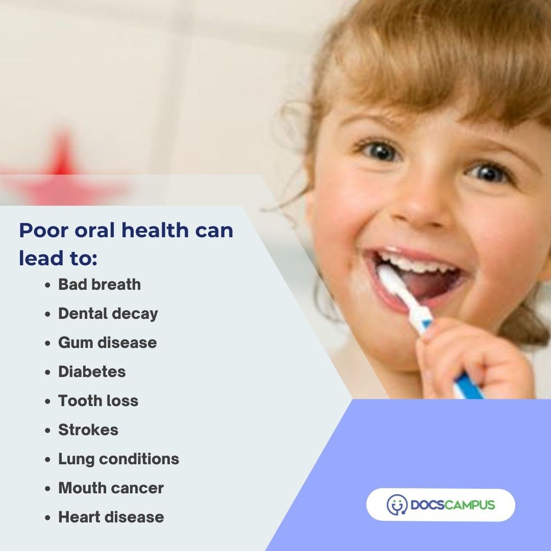 DocsCampus's tweet photo. Bacteria can build-up to the point where they cause oral infections like tooth decay and gum disease if adequate oral hygiene is not practiced.

"If one's eyes are windows to one's soul, one's mouth is the window to one's total health."

#badbreath #oralhygiene #DocsCampus https://t.co/SOjfHAHLgm
