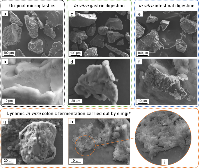 Aún se sabe muy poco sobre el efecto en nuestra salud de ingerir #plástico. Este estudio ha encontrado que el PET altera la comunidad bacteriana del colon disminuyendo las bacterias beneficiosas y aumentando la presencia de otras que pueden ser patógenas.
nature.com/articles/s4159…