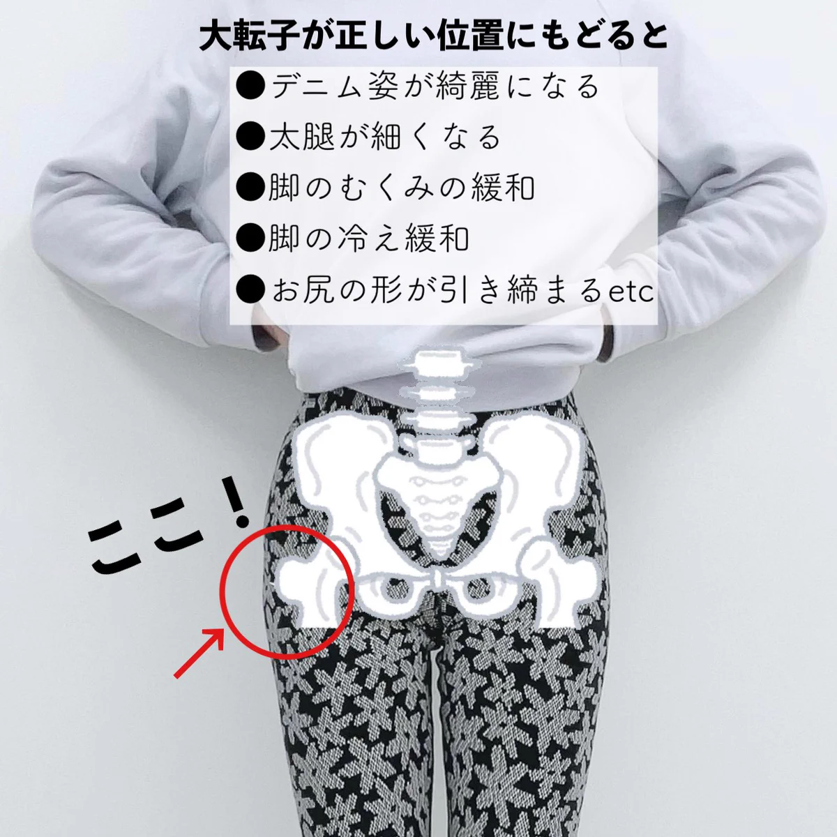 1回でもサイズダウン！？大転子のでっぱりに効く！女性必見のストレッチ方法